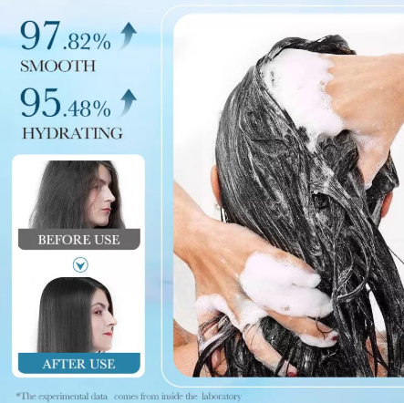 ✨Last Day 49% OFF -Aloe Anti-dandruff Repair Shampoo